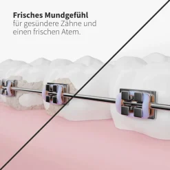Ersatzdüsen Sensitiv schwarz (9 Stück) - für sensibles Zahnfleisch & Zähne|zahnheld Best