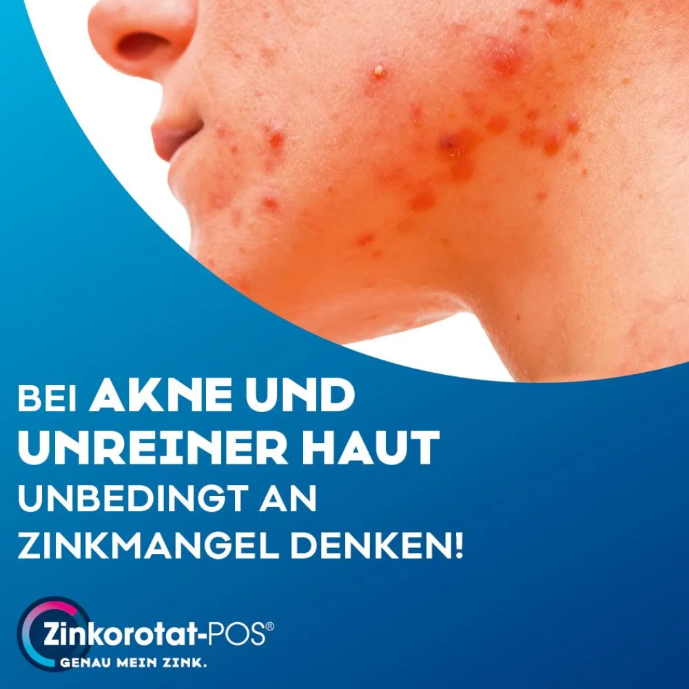 at-POS® 40 mg|Zinkorot Outlet